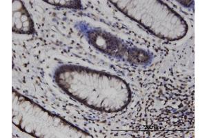 Immunoperoxidase of monoclonal antibody to MLKL on formalin-fixed paraffin-embedded human colon.
