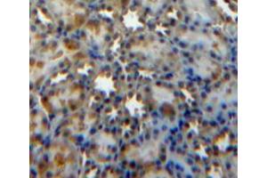 Used in DAB staining on fromalin fixed paraffin-embedded kidney tissue (SOCS3 anticorps  (AA 1-225))