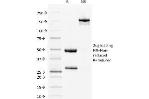 SDS-PAGE Analysis Purified Estrogen Receptor alpha Mouse Monoclonal Antibody (ESR1/1904).