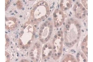 Detection of CX43 in Human Kidney Tissue using Polyclonal Antibody to Connexin 43 (CX43)