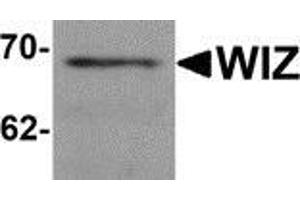 Western blot analysis of WIZ in rat lung tissue lysate with WIZ antibody at 1 μg/ml. (WIZ anticorps  (C-Term))