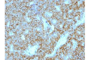 Formalin-fixed, paraffin-embedded human Parathyroid Gland stained with PTH Mouse Monoclonal Antibody (PTH/1175). (PTH anticorps  (AA 32-115))