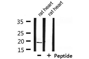 Western blot analysis of extracts from rat heart, using INSL4 Antibody. (INSL4 anticorps)