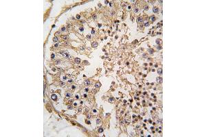 Immunohistochemistry (IHC) image for anti-B-Cell CLL/lymphoma 2 (BCL2) (BH3 Domain) antibody (ABIN2997097) (Bcl-2 anticorps  (BH3 Domain))