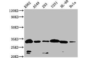 Western Blot Positive WB detected in: K562 whole cell lysate,A549 whole cell lysate,293 whole cell lysate,U251 whole cell lysate,HL-60 whole cell lysate,Hela whole cell lysate All lanes: VDAC3 antibody at 1:1000 Secondary Goat polyclonal to rabbit IgG at 1/50000 dilution Predicted band size: 31 kDa Observed band size: 32 kDa (VDAC3 anticorps  (AA 40-160))