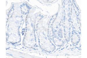 Immunohistochemistry (IHC) image for anti-Tripartite Motif Containing 24 (TRIM24) (AA 700-750) antibody (ABIN7454678) (TRIM24 anticorps  (AA 700-750))