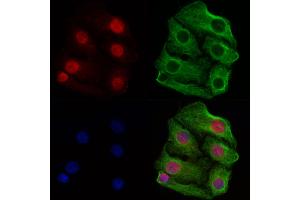 ABIN6260261 and ABIN6269348 staining Hela cells by IF/ICC. (BIK anticorps  (N-Term))