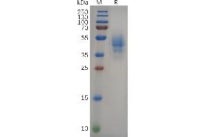 Human NEFL(9-88) Protein, hFc Tag on SDS-PAGE under reducing condition.