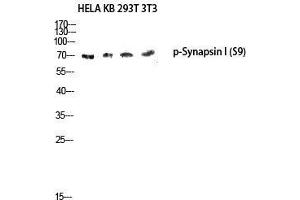 Western Blot (WB) analysis of HeLa KB 293T 3T3 lysis using Phospho-Synapsin I (S9) antibody.