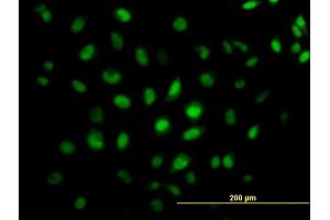 Immunofluorescence of monoclonal antibody to CREB5 on HeLa cell. (CREB5 anticorps  (AA 1-99))