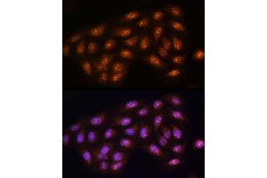 Immunofluorescence analysis of U2OS cells using [KO Validated] PPP1CC Rabbit pAb (ABIN1682257, ABIN3018437, ABIN3018438 and ABIN5664595) at dilution of 1:100 (40x lens). (PPP1CC anticorps  (AA 1-323))