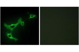 Immunofluorescence analysis of NIH-3T3 cells, using TRIM3 Antibody. (TRIM3 anticorps  (AA 1-50))