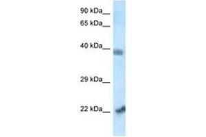 Image no. 1 for anti-Vacuolar Protein Sorting 72 Homolog (S. Cerevisiae) (VPS72) (N-Term) antibody (ABIN6747513) (VPS72 anticorps  (N-Term))