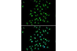Immunofluorescence analysis of A549 cells using CXXC1 antibody. (CXXC1 anticorps)