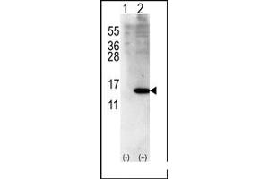 Image no. 1 for anti-ISG15 Ubiquitin-Like Modifier (ISG15) (Middle Region) antibody (ABIN356681) (ISG15 anticorps  (Middle Region))