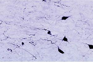 Immunohistochemical staining of HCRTR1 in rat zona incerta neurons using HCRTR1 polyclonal antibody , at a dilution of 1 : 1000. (HCRTR1 anticorps  (AA 12-33))