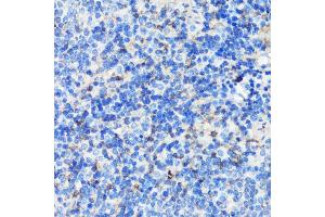 Immunohistochemistry of paraffin-embedded mouse spleen using Filamin A antibody (ABIN7267206) at dilution of 1:100 (40x lens). (Filamin A anticorps  (C-Term))