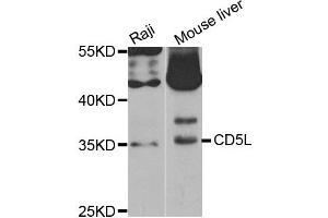 Western Blotting (WB) image for anti-CD5 Molecule-Like (CD5L) antibody (ABIN1882350) (CD5L anticorps)
