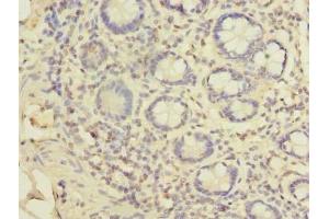 Immunohistochemistry of paraffin-embedded human small intestine tissue using ABIN7151342 at dilution of 1:100 (TSSC1 anticorps  (AA 201-387))