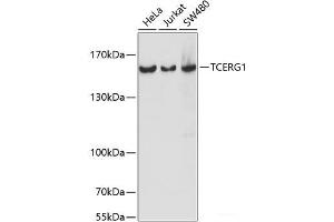 Western blot analysis of extracts of various cell lines using TCERG1 Polyclonal Antibody at dilution of 1:1000. (TCERG1 anticorps)