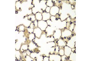 Immunohistochemistry of paraffin-embedded mouse lung using IFRD1 antibody at dilution of 1:100 (x400 lens).