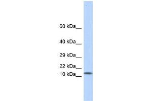 WB Suggested Anti-LGALS1 Antibody Titration: 0. (LGALS1/Galectin 1 anticorps  (Middle Region))