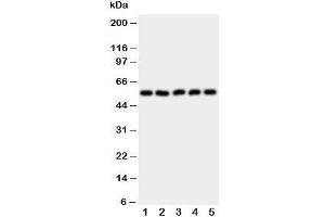 Western blot testing of HYAL2 antibody and Lane 1:  HeLa;  2: SMMC-7721;  3: COLO320;  4: MCF-7;  5: HT1080 cell lysate (HYAL2 anticorps  (AA 142-157))
