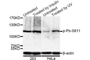 Western blot analysis of extracts of 293 and HeLa cells, using Phospho-Rb-S811 antibody (ABIN5969933) at 1/1000 dilution. (Retinoblastoma 1 anticorps  (pSer811))