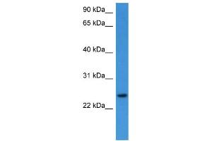 WB Suggested Anti-RHOG  Antibody Titration: 0. (RHOG anticorps  (C-Term))