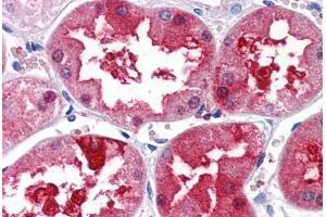 Human Kidney (formalin-fixed, paraffin-embedded) stained with PLXDC1 antibody ABIN351450 at 5 ug/ml followed by biotinylated goat anti-rabbit IgG secondary antibody ABIN481713, alkaline phosphatase-streptavidin and chromogen. (PLXDC1 anticorps  (Internal Region))