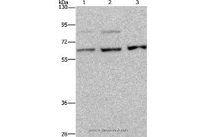 Western blot analysis of A431, MCF-7 and Hela cell, using KIF22 Polyclonal Antibody at dilution of 1:200 (KIF22 anticorps)