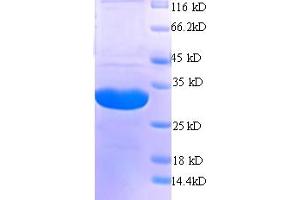 SDS-PAGE (SDS) image for HLA-DR-gamma (CD74) (AA 56-279), (Extracellular) protein (His tag) (ABIN5709245)
