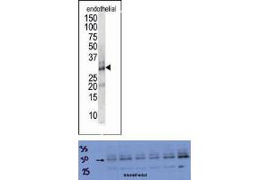 TOP: The anti-DSCR1 Pab is used in Western blot to detect DSCR1 in endothelial cell lysate. (RCAN1 anticorps  (Middle Region))