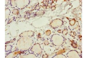 Immunohistochemistry of paraffin-embedded human thyroid tissue using ABIN7170586 at dilution of 1:100 (SPICE1 anticorps  (AA 1-220))