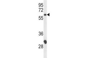Western blot analysis of CD4 antibody and CEM lysate; Expected size: 40~60 kDa depending on glycosylation level