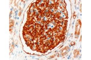 ABIN185496 (3µg/ml) staining of paraffin embedded Human Kidney. (SLC9A3R2 anticorps  (Internal Region))