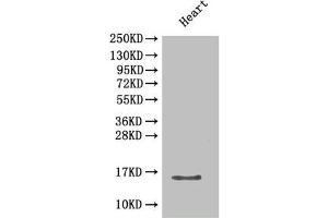 Western Blot Positive WB detected in: Mouse heart tissue All lanes: Cxcl5 antibody at 2 μg/mL Secondary Goat polyclonal to rabbit IgG at 1/50000 dilution Predicted band size: 15 kDa Observed band size: 15 kDa (CXCL5 anticorps  (AA 46-117))