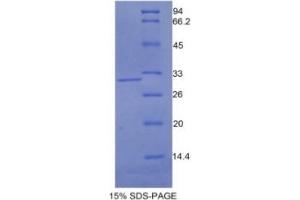 SDS-PAGE of Protein Standard from the Kit (Highly purified E.