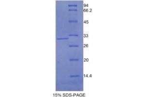 SDS-PAGE of Protein Standard from the Kit (Highly purified E. (N-Cadherin Kit ELISA)