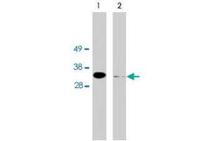 Western blot using FHL2 polyclonal antibody on HeLa cell extract (10 ug/lane). (FHL2 anticorps)