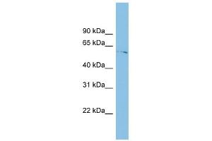 TINAGL1 antibody used at 1 ug/ml to detect target protein. (TINAGL1 anticorps  (Middle Region))