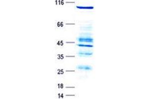 Validation with Western Blot