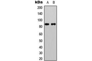 Western blot analysis of Beta-catenin (pS33) expression in HeLa (A), HepG2 (B) whole cell lysates. (beta Catenin anticorps  (N-Term, pSer33))