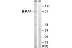 Western blot analysis of extracts from 293 cells, treated with insulin 0. (SNRPE anticorps  (AA 411-460))