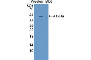 Figure. (GPLD1 anticorps  (AA 496-840))