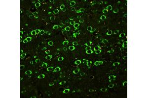 Anti-SSH3BP1 antibody, IHC(P) IHC(P): Rat Brain Tissue