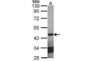 WB Image Sample (30 ug of whole cell lysate) A: NT2D1 10% SDS PAGE antibody diluted at 1:2000 (Septin 2 anticorps)
