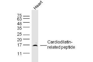 Mouse heart lysates probed with Cardiodilatin-related peptide Polyclonal Antibody, Unconjugated  at 1:300 dilution and 4˚C overnight incubation. (NPPA anticorps  (AA 26-55))