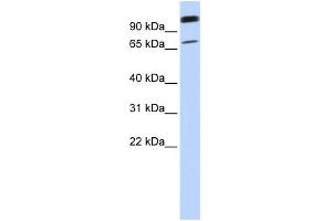WB Suggested Anti-LST-3TM12 Antibody Titration:  0. (LST-3TM12 anticorps  (Middle Region))
