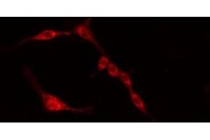 ABIN6274384 staining HeLa cells by IF/ICC.